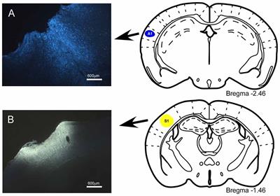 Bilateral Pathways from the Basal Forebrain to Sensory Cortices May Contribute to Synchronous Sensory Processing